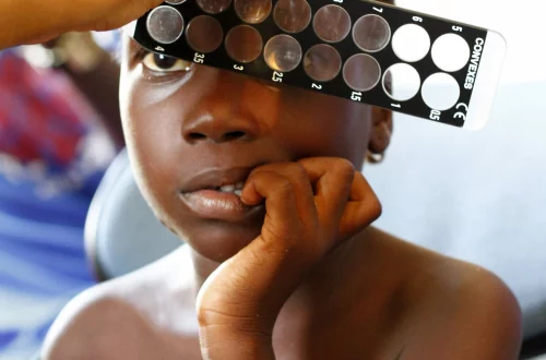Niña durante una revisión de la vista en Dakar